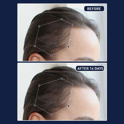 🎁عرض اليوم: خصم 𝟔𝟓% على 𝐅𝐄𝐆™ - بخاخ نمو الشعر